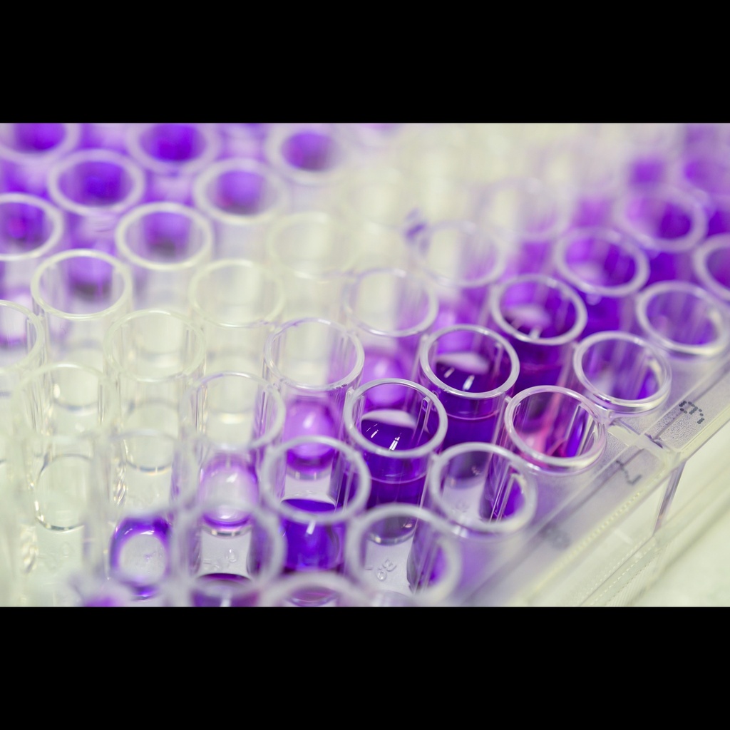 Mouse IgG ELISA, IGGsize:1, 96 tests