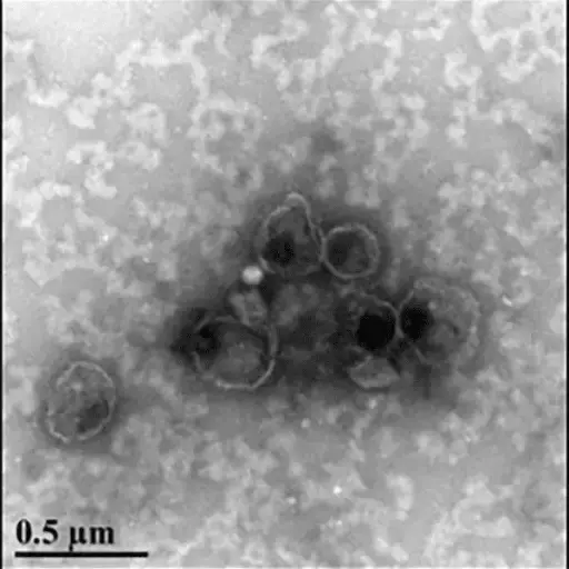 [EQULTRA-20TC-1] ExoQuick Ultra TC (20 rxns)
